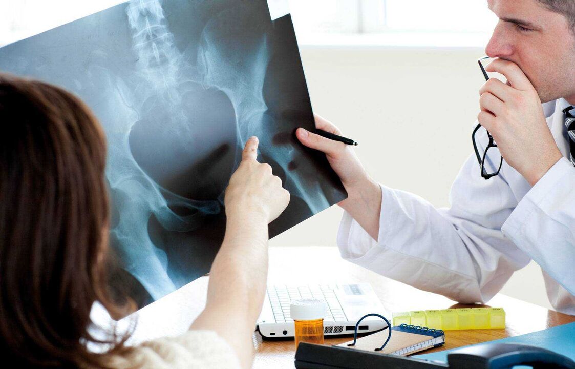 mga doktor nga nagsusi sa x-ray alang sa hip arthrosis